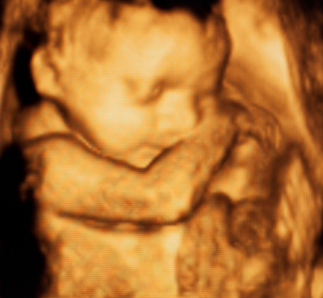 Peek – A – Boo (22 Weeks)