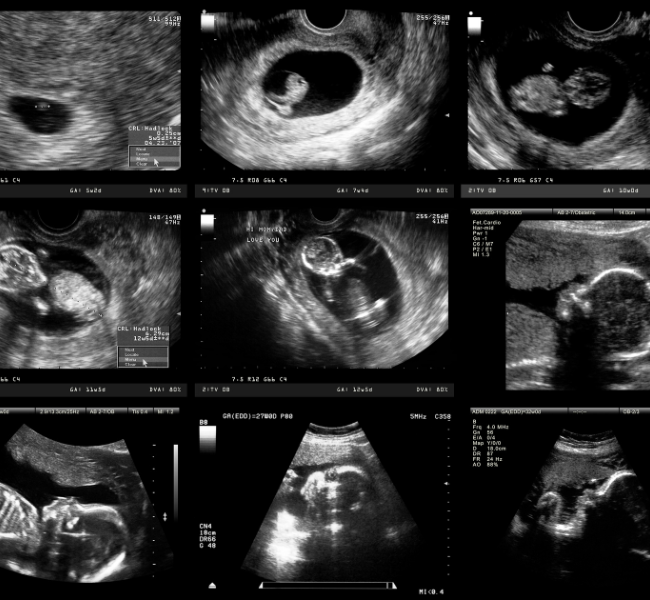 Half-Pint Peeks – 10 visits